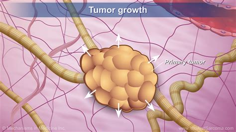 what test to view soft tissue|Soft tissue sarcoma .